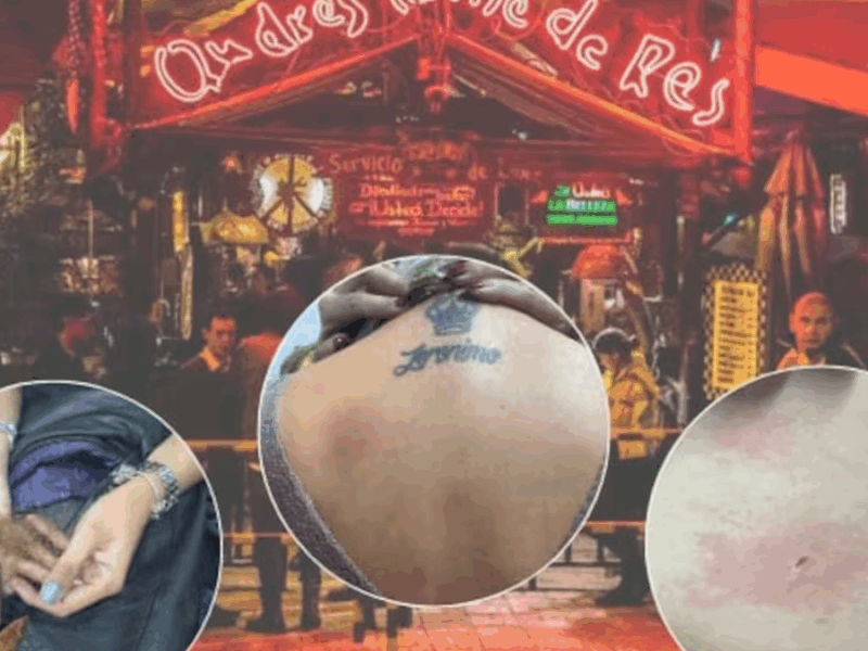 denuncian fallas en maquina de humo en andres carne de res quemaduras ropa destruida y caida de cabello en bogota web 67