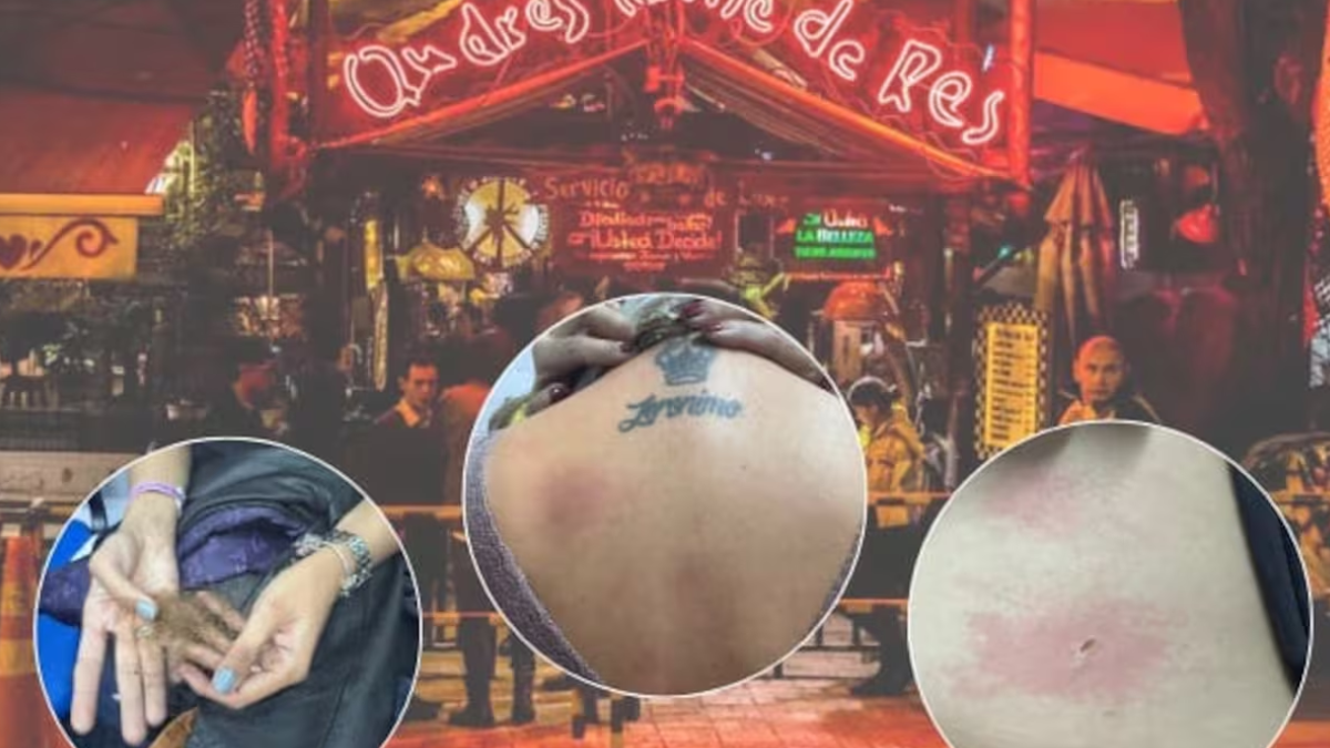 denuncian fallas en maquina de humo en andres carne de res quemaduras ropa destruida y caida de cabello en bogota web 67