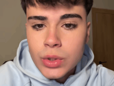 Tiktoker alerta a jóvenes tras ser diagnosticado con edema pulmonar por vapear