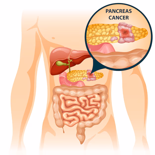 concepto-organos-humanos-digestivos-dibujos-animados_1284-37722 cientificos espanoles eliminaron tumores pancreaticos en ratones sin efectos adversos un avance inedito frente a uno de los canceres mas dificiles de tratar concepto organos humanos digestivos dibujos